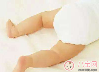 寶寶腿太彎怎么辦     怎么讓寶寶有一雙筆直的腿