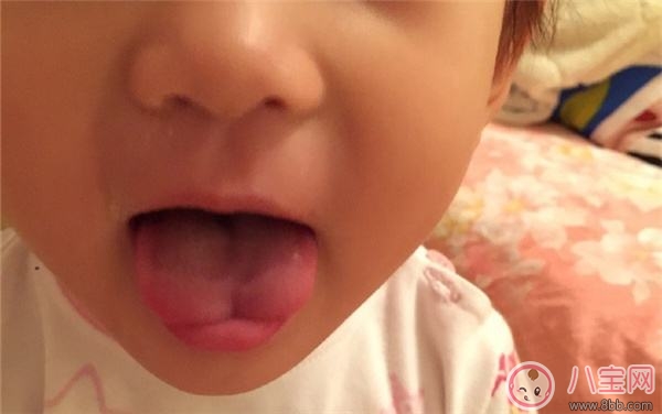 嬰兒舌尖正常該是什么形狀 為什么寶寶舌尖是w形狀 嬰兒舌尖正常該是什么形狀 為什么寶寶舌尖是w形狀