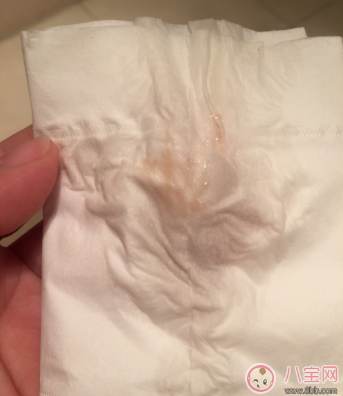 懷孕褐色分泌物是男孩 懷孕初期有褐色分泌物流出是男孩嗎