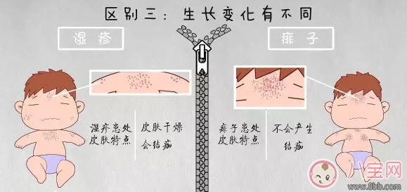 寶寶痱子和濕疹的區別 濕疹和痱子的區別圖片 寶寶痱子和濕疹的區別 濕疹和痱子的區別圖片