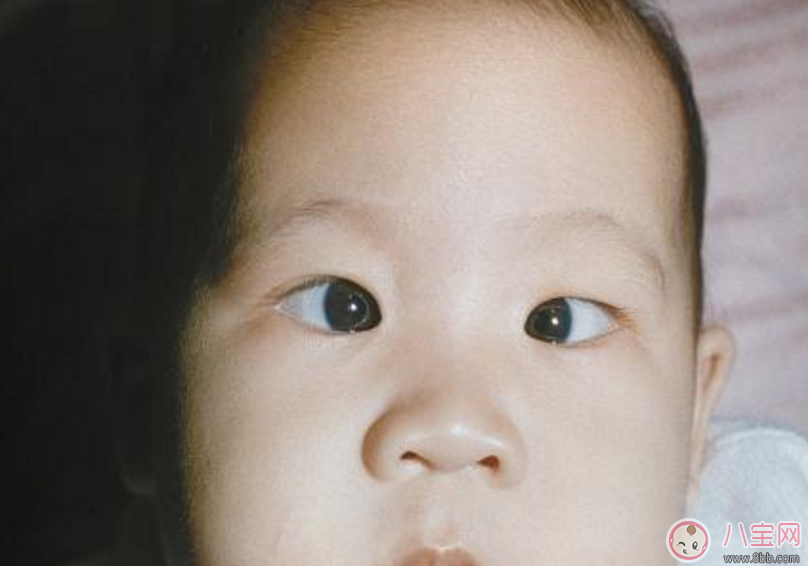 孩子內斜視怎么辦 怎么糾正孩子內斜視 孩子內斜視怎么辦 怎么糾正孩子內斜視