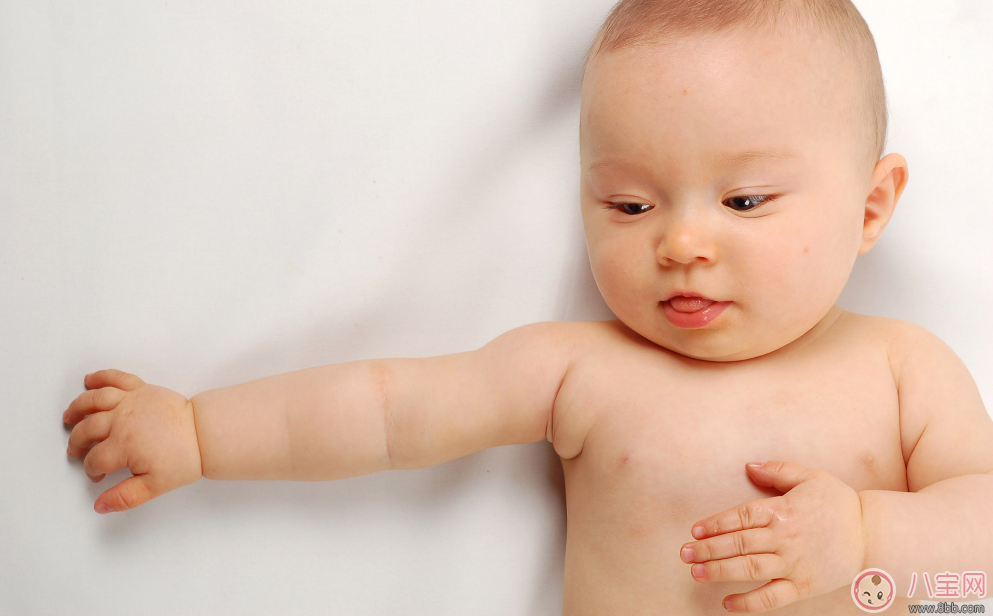 糖寶寶在嬰兒時(shí)期有哪些癥狀 怎么預(yù)防唐氏綜合癥 糖寶寶在嬰兒時(shí)期有哪些癥狀 怎么預(yù)防唐氏綜合癥