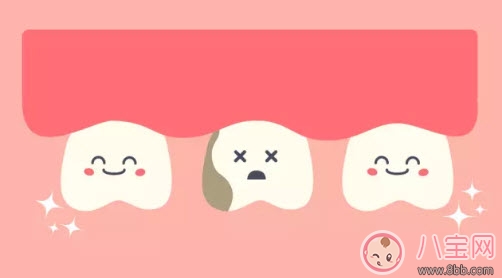 董潔兒子頂頂四顆蛀牙 寶寶更易患蛀牙問題