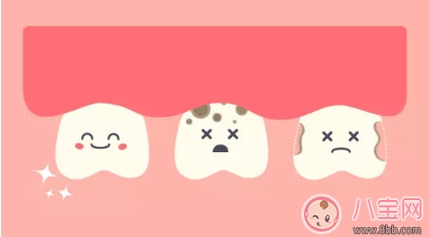 董潔兒子頂頂四顆蛀牙 寶寶更易患蛀牙問題