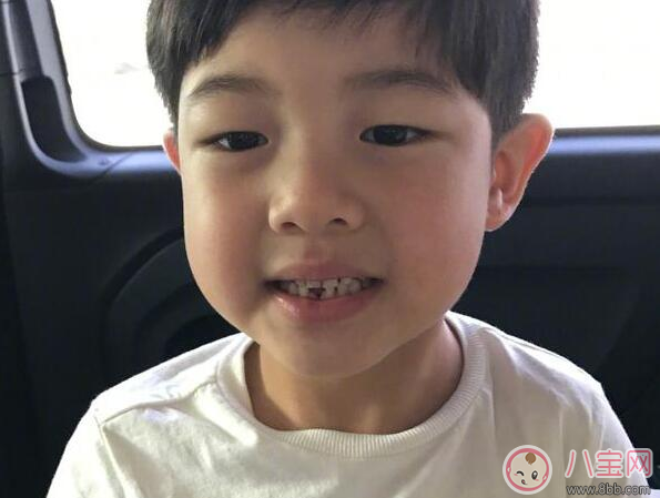 孩子出牙晚是福氣好嗎 哪些情況會影響孩子出牙