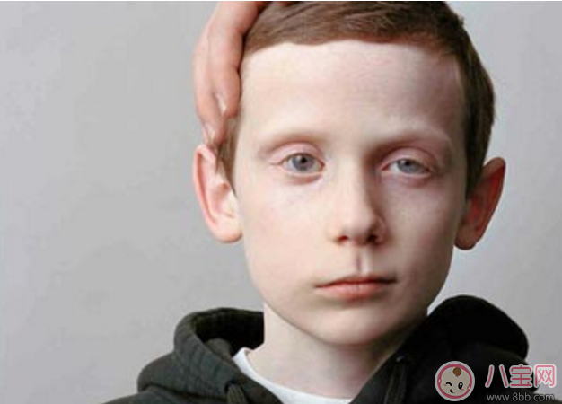 兒童吹空調竟然導致面癱 如何正確吹空調