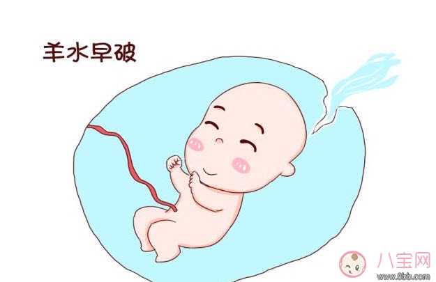 孕中期羊水早破的癥狀 如何預防羊水早破