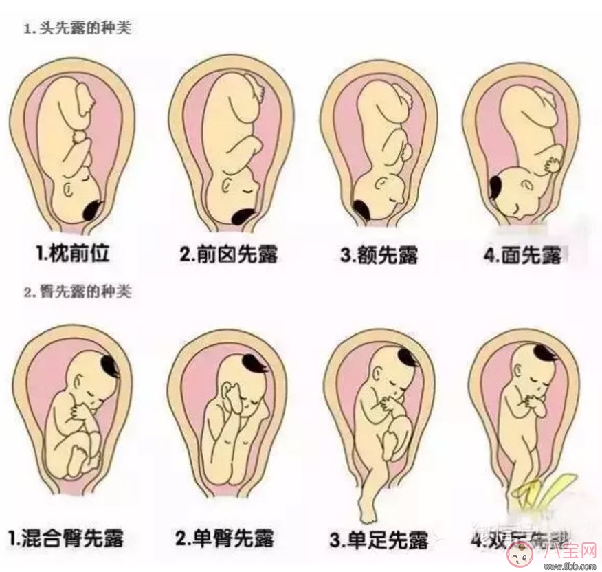 孕晚期胎位不正怎么辦 孕晚期胎位圖