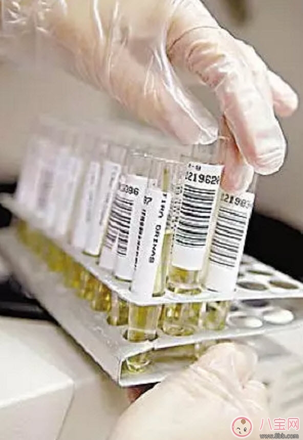 進行驗孕前應該知道哪些常識性問題 可能你還不知道 進行驗孕前應該知道哪些常識性問題 可能你還不知道