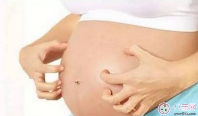 孕婦皮膚癢怎么辦 孕婦身體癢怎么緩解