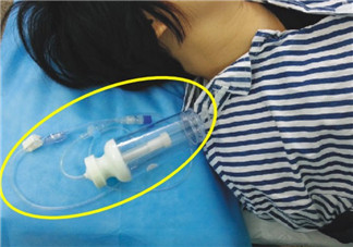 剖腹產的過程是怎么樣的 剖腹產手術前手術中手術后流程揭秘