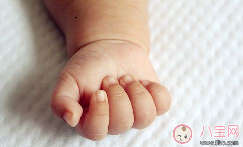 孩子手上長倒刺 寶媽應該這么做 孩子手上長倒刺 寶媽應該這么做