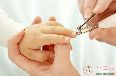 孩子手上長倒刺 寶媽應該這么做 孩子手上長倒刺 寶媽應該這么做