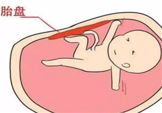 胎盤三級就已經老化了嗎 胎盤老化判斷標準