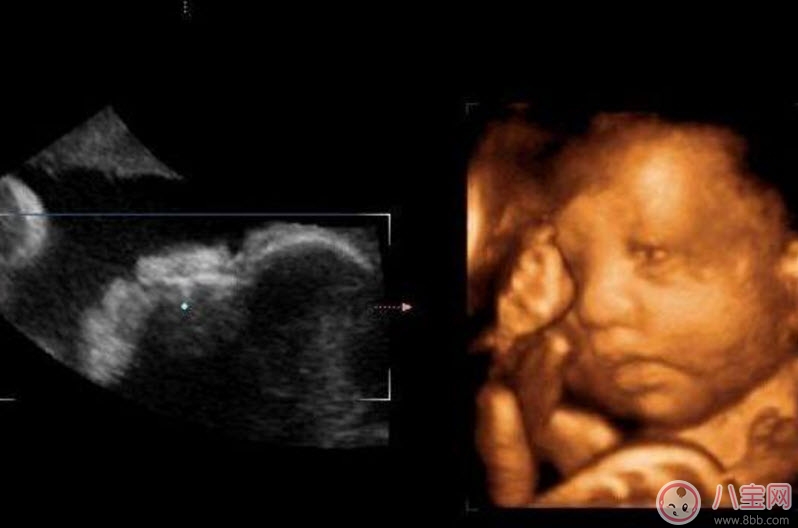 孕婦四維彩超的最佳時間 孕婦一定要做四維彩超嗎