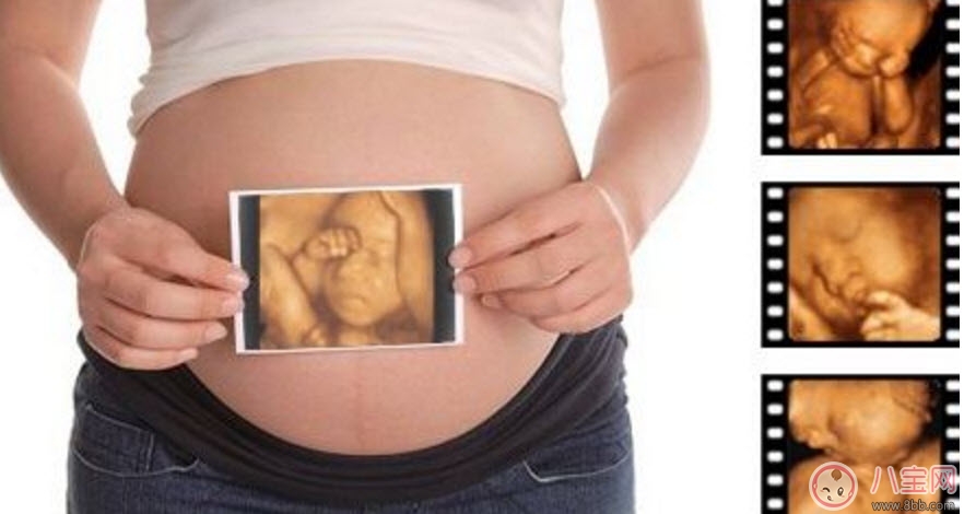 孕婦四維彩超的最佳時間 孕婦一定要做四維彩超嗎