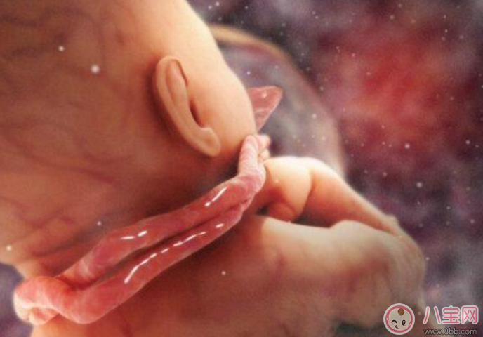 臍帶繞頸怎么辦 嬰兒臍帶繞頸嚴重嗎 臍帶繞頸怎么辦 嬰兒臍帶繞頸嚴重嗎