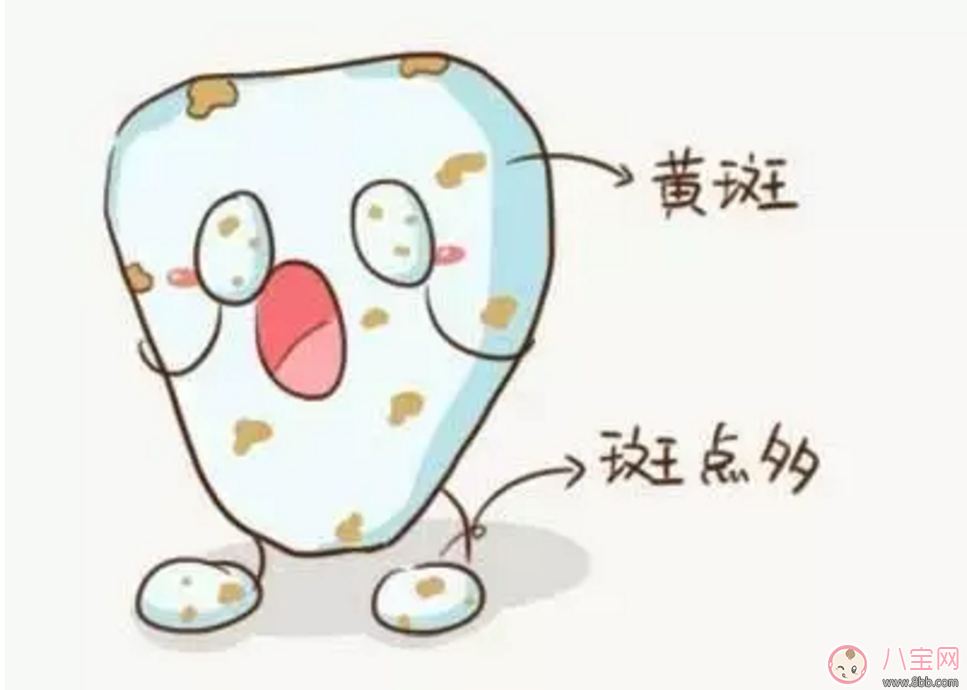 寶寶沒有齲齒 卻有黑牙是怎么回事？