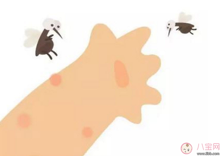 寶寶被臭蟲咬了癥狀圖片 寶寶被臭蟲咬和蚊子咬癥狀對比圖片區別