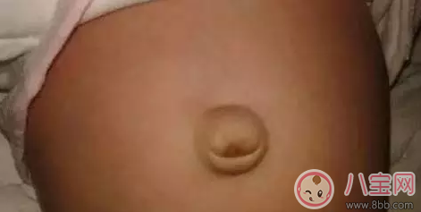 孩子肚臍臟了怎么辦 就算你有強迫癥也不能摳