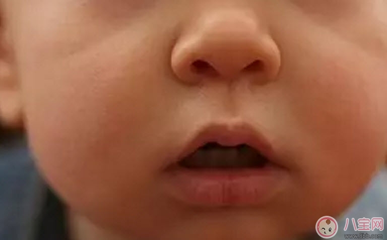 秋天怎么預防寶寶口角炎 寶寶口角炎的食療方法 秋天怎么預防寶寶口角炎 寶寶口角炎的食療方法