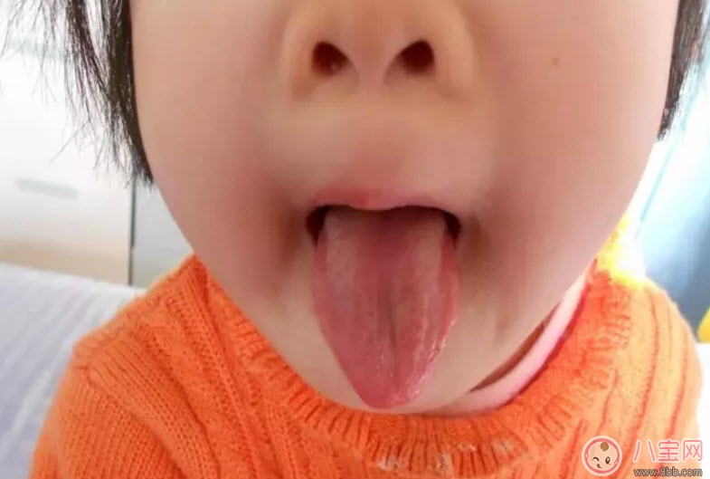 寶寶積食發燒和感冒發燒的區別癥狀 寶寶積食發燒怎么解決