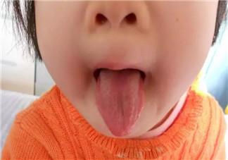 寶寶積食發燒和感冒發燒的區別癥狀 寶寶積食發燒怎么解決