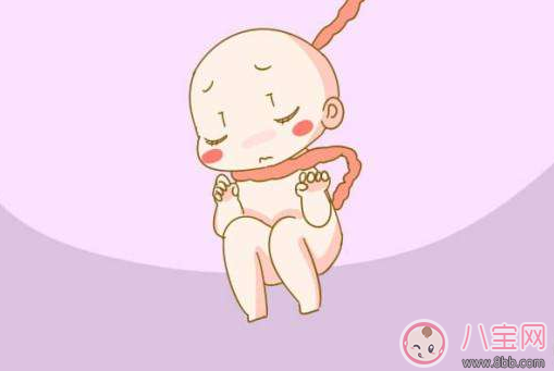 擔心胎兒臍帶繞頸怎么辦 預防臍帶繞頸方法推薦 擔心胎兒臍帶繞頸怎么辦 預防臍帶繞頸方法推薦