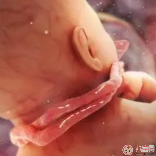 胎兒臍帶繞頸怎么辦？產前怎樣化解臍帶繞頸？