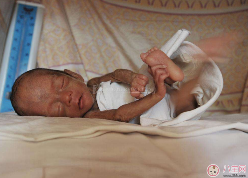 早產的孩子怎么養 孩子早產要放在保溫箱幾天