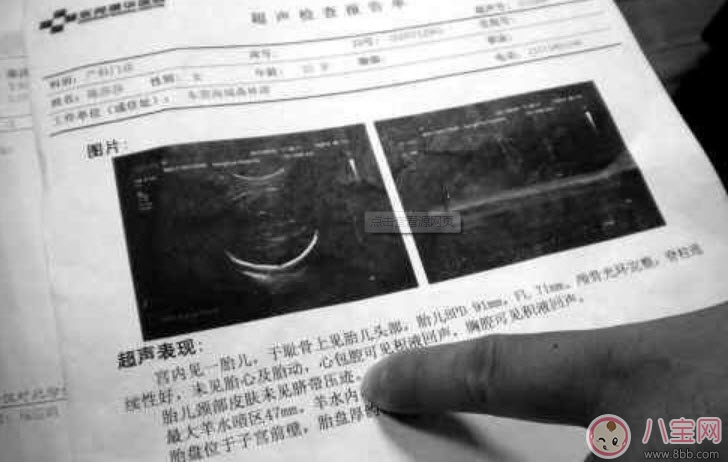 產檢報告單到底怎么看 產檢糖耐量結果怎么看