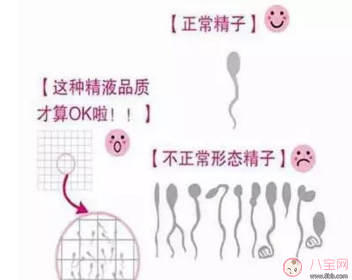 男性精子畸形不液化的原因什么 精子液化不良癥狀表現 男性精子畸形不液化的原因什么 精子液化不良癥狀表現