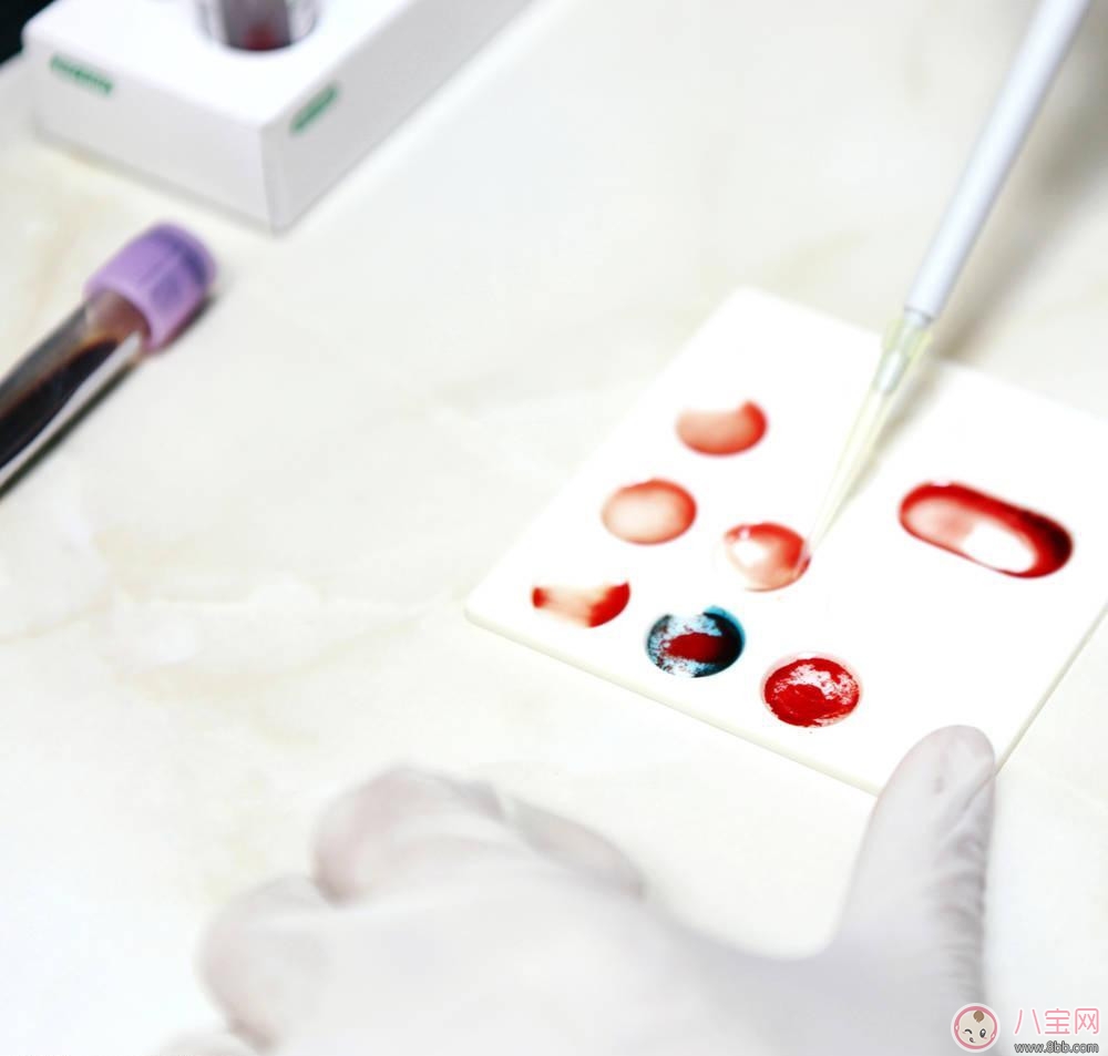 寶寶驗血單怎么看？怎么了解寶寶驗血項目？