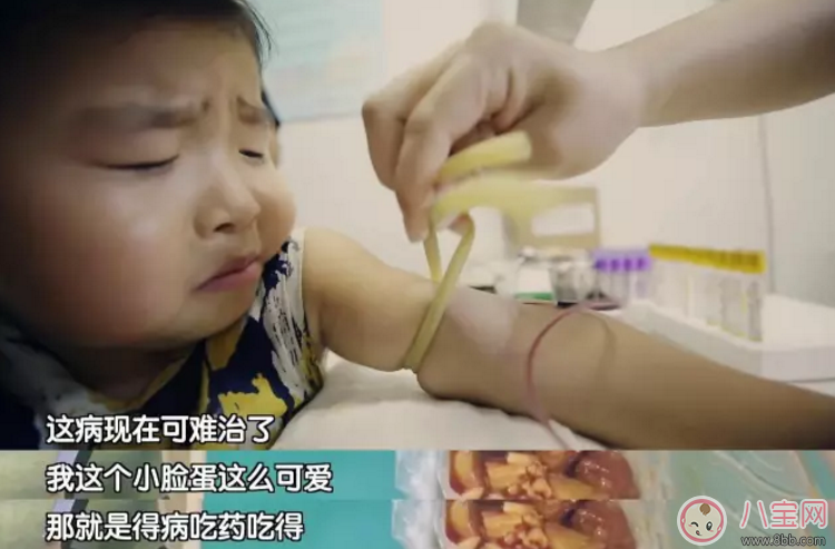 李欣蕊得了什么病 了不起的孩子萌娃李欣蕊腎病綜合征能治好嗎 李欣蕊得了什么病 了不起的孩子萌娃李欣蕊腎病綜合征能治好嗎