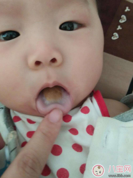寶寶有口臭怎么調(diào)理 孩子口臭怎么辦 寶寶有口臭怎么調(diào)理 孩子口臭怎么辦