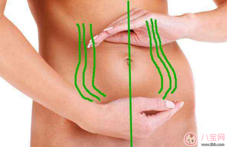 腹直肌分離自測方法 腹直肌分離的危害有哪些