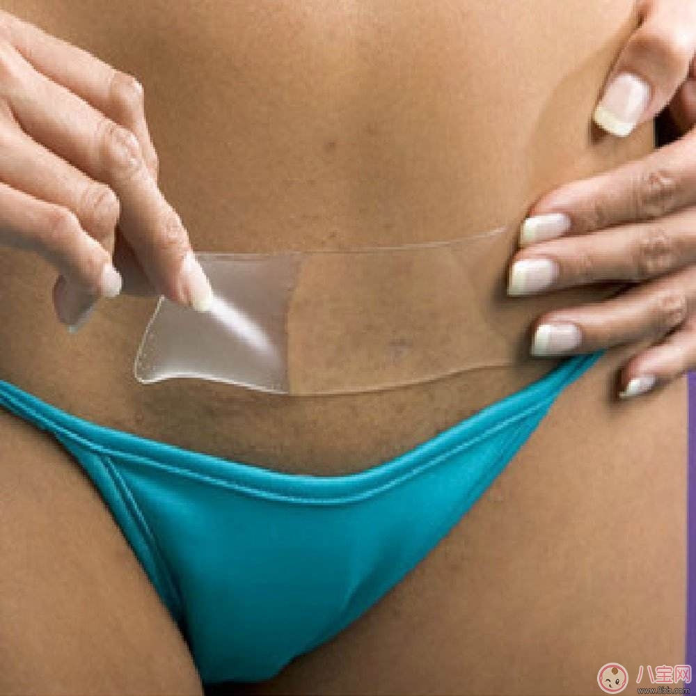 如何修復剖腹產后的疤痕 消除剖腹產疤痕有哪些方法