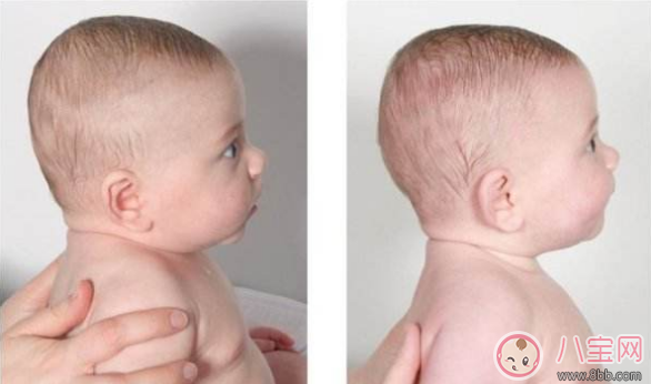 睡姿影響寶貝頭型的關鍵因素真的嗎 怎么樣讓寶寶換睡姿頭型更好看 睡姿影響寶貝頭型的關鍵因素真的嗎 怎么樣讓寶寶換睡姿頭型更好看