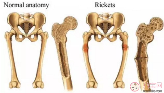 維生素D怎么補充比較好 孩子出生多久后要補充維生素D 維生素D怎么補充比較好 孩子出生多久后要補充維生素D