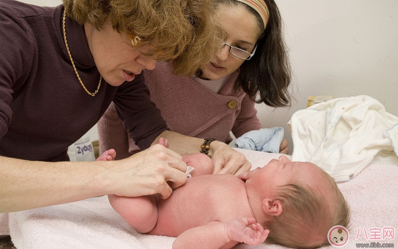 如何照顧新生兒的臍帶 什么情況應該帶寶寶就醫治療