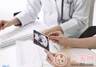 nt檢查是什么檢查項目nt檢查怎么看 nt檢查結果異常怎么辦