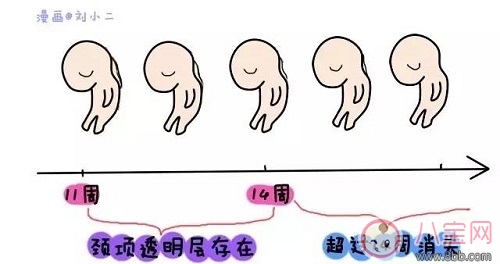 nt檢查是什么檢查項目nt檢查怎么看 nt檢查結果異常怎么辦
