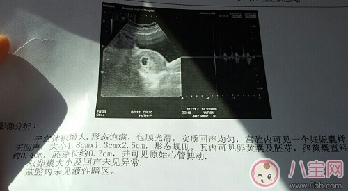 懷孕6 7周未見胎心胎芽正常嗎 胎芽胎心什么時候出現胎芽胎心對照表 懷孕6 7周未見胎心胎芽正常嗎 胎芽胎心什么時候出現胎芽胎心對照表