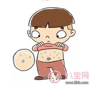 寶寶和孕婦得了蕁麻疹能用爐甘石洗劑嗎 爐甘石洗劑真的有效嗎