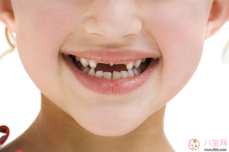 寶寶牙齒摔松了怎么辦 怎么正確呵護寶寶的牙齒 寶寶牙齒摔松了怎么辦 怎么正確呵護寶寶的牙齒