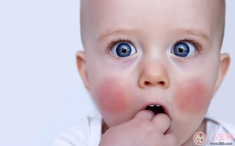 寶寶眼屎多的上火嗎 如何正確的清理寶寶眼屎