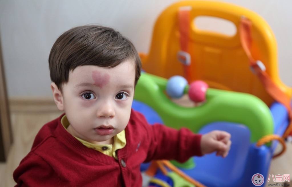 如何認識孩子的胎記類型 寶寶什么胎記是疾病信號