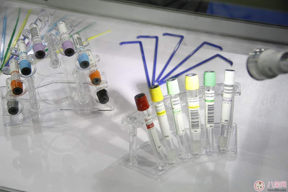 為什么孕期要做血常規檢查 孕初期不做血常規檢查行不行