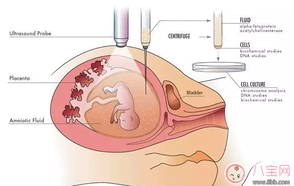 染色體異常能要孩子嗎 染色體異常怎么治 染色體異常能要孩子嗎 染色體異常怎么治