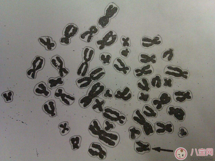 染色體異常能要孩子嗎 染色體異常怎么治 染色體異常能要孩子嗎 染色體異常怎么治